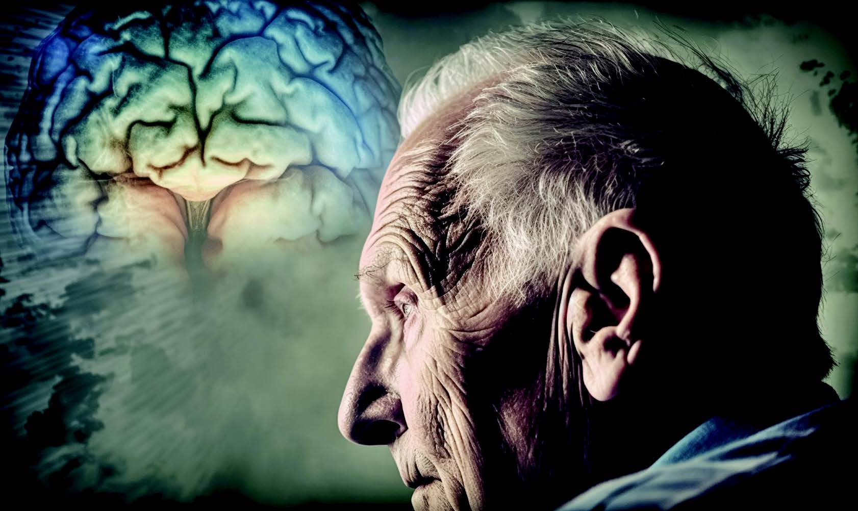 Parkinson’s Disease Dementia (PDD) and Alzheimer’s Disease (AD) - Greater Kashmir